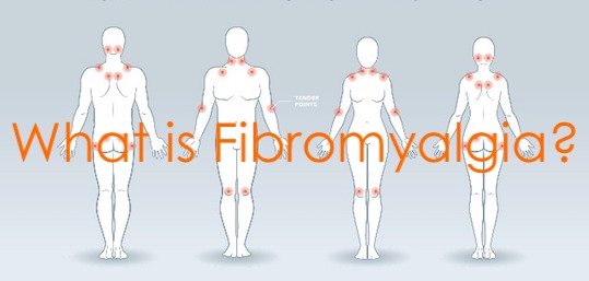 What is Fibromyalgia?