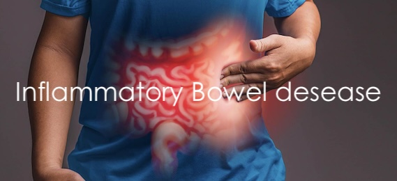 Inflammatory Bowel Disease